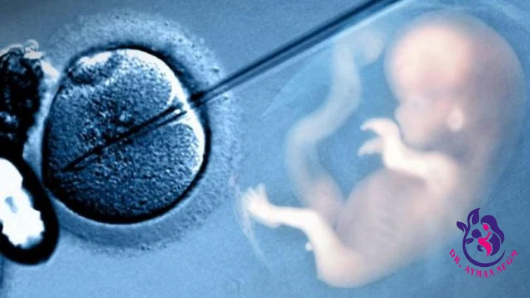 ما هو ICSI-IVF ، لماذا يتم ذلك ، وما إذا كان آمنا؟
