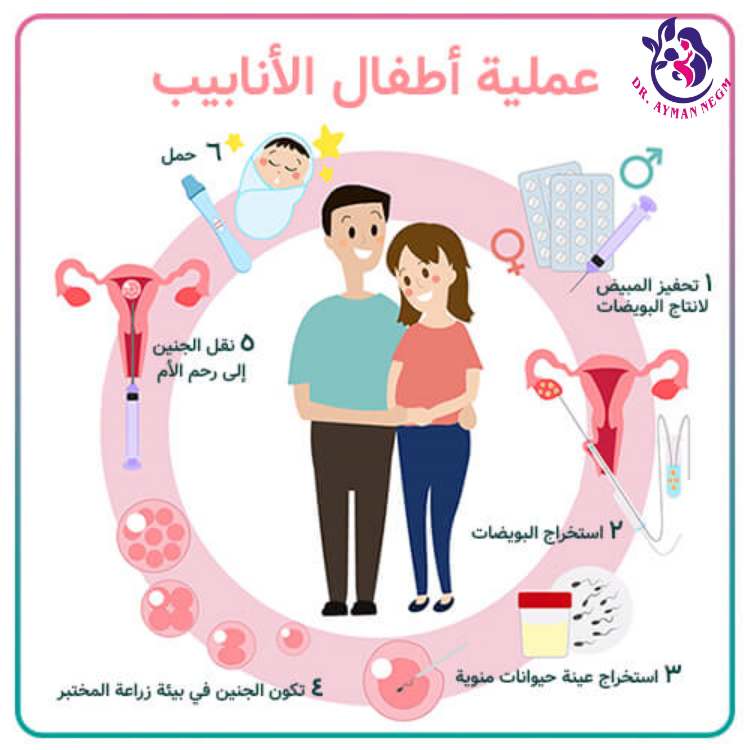 ماهو طفل الانابيب؟ ماهو طفل الانابيب؟