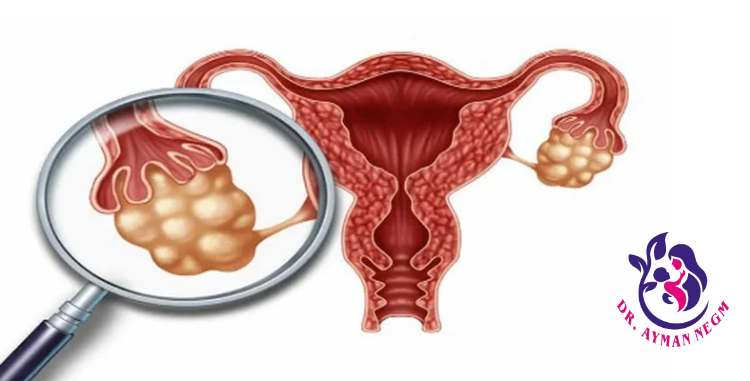 تكلفة عملية اطفال الانابيب تكلفة عملية اطفال الانابيب
