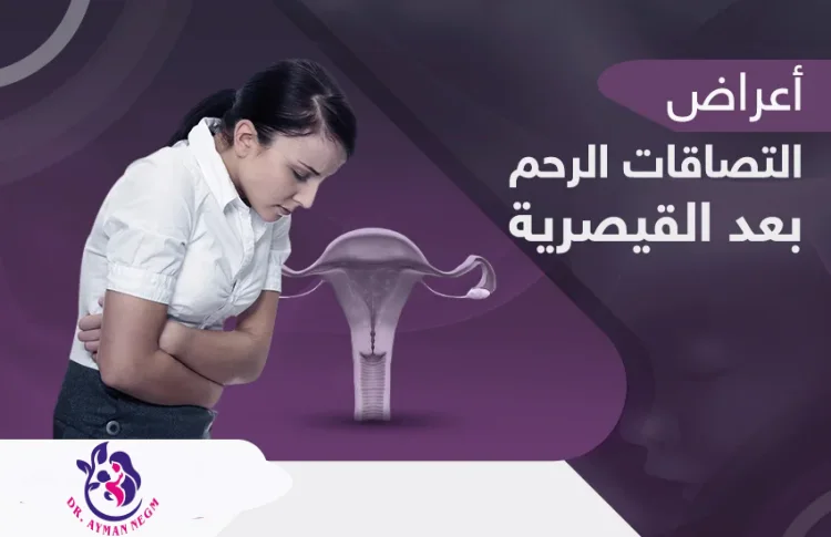 متى تظهر الالتصاقات بعد القيصرية