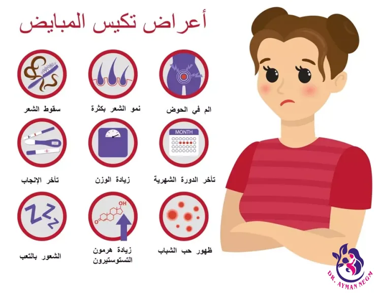 اعراض تكيس المبايض الخفيف