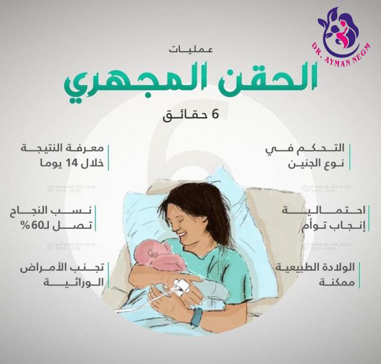 ماهي عملية الحقن المجهري؟