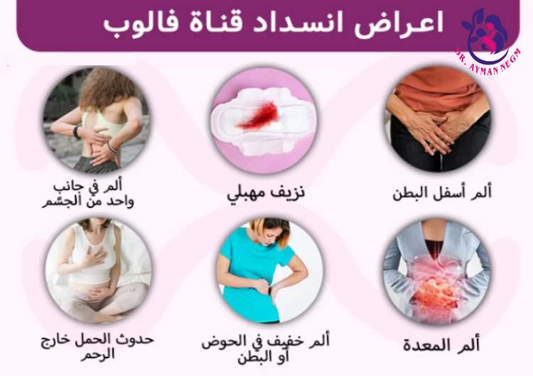 اعراض انسداد الانابيب وقت الدورة