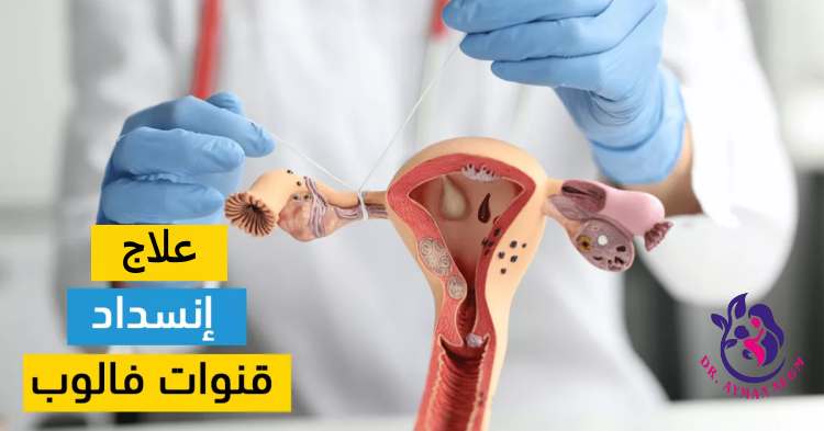 افضل علاج لانسداد قناة فالوب