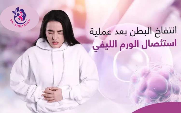 انتفاخ البطن بعد عملية استئصال الورم الليفي