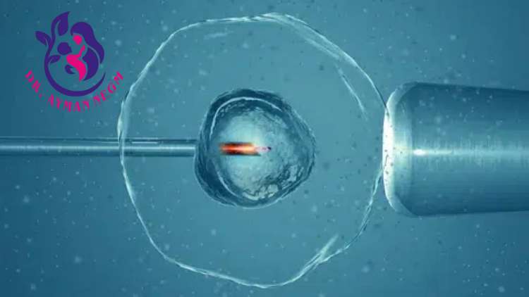 تكلفة الحقن المجهري وتحديد نوع الجنين