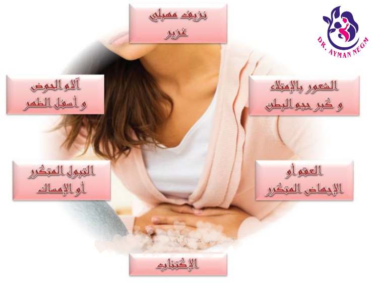 أعراض الورم الليفي