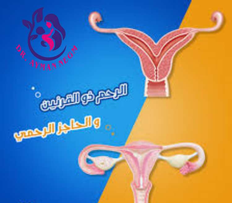 الفرق بين الحاجز الرحمي والرحم ذو القرنين