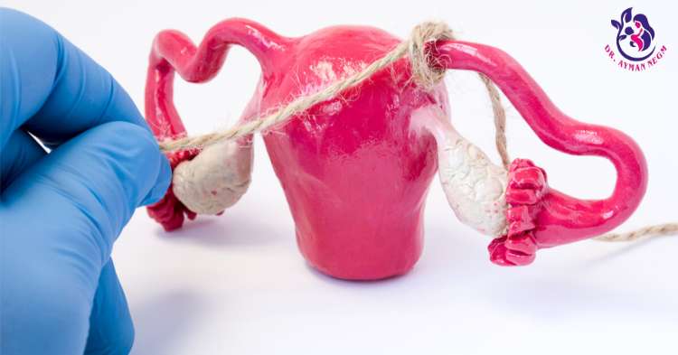 تكلفة عملية ربط الرحم لمنع الحمل