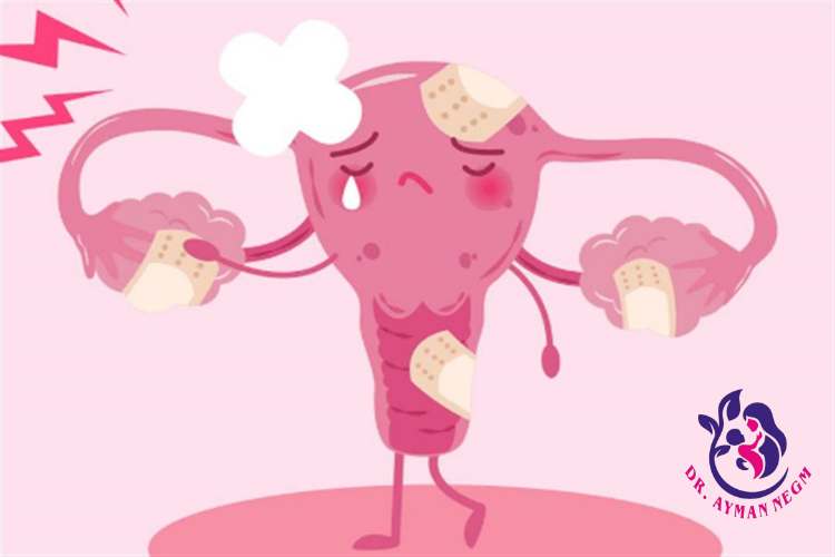 علامات ضعف التبويض وقت الدوره
