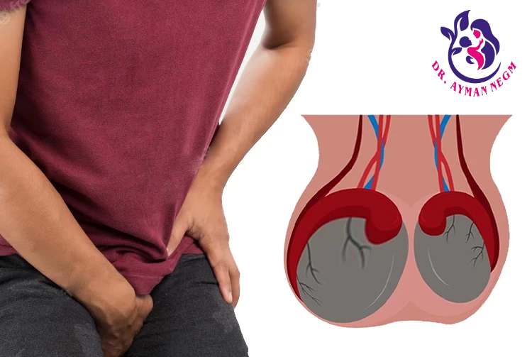ما سبب تورم الخصية بعد عملية سحب عينة