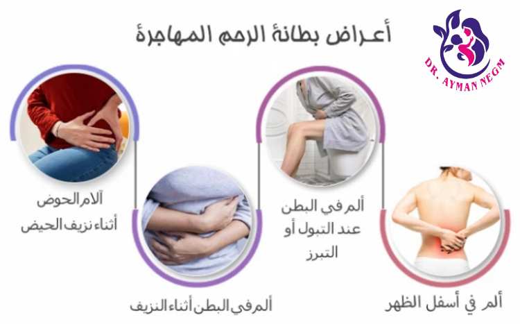 أعراض بطانة الرحم المهاجرة  