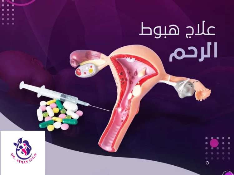 علاج سقوط الرحم بدون جراحة