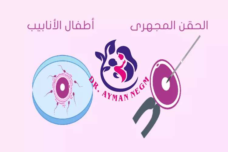 الفرق بين الحقن المجهري وأطفال الأنابيب