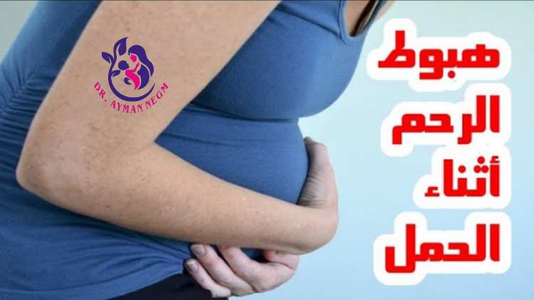 هبوط الرحم والحمل