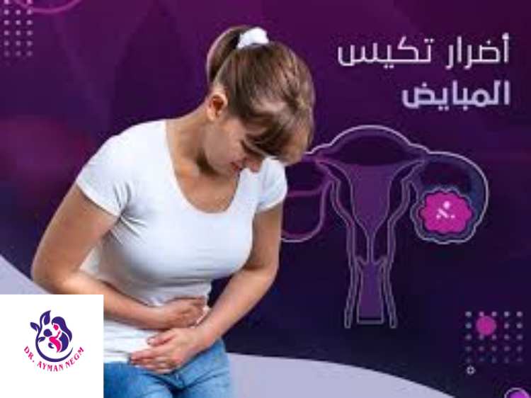 اضرار تكيس المبايض 