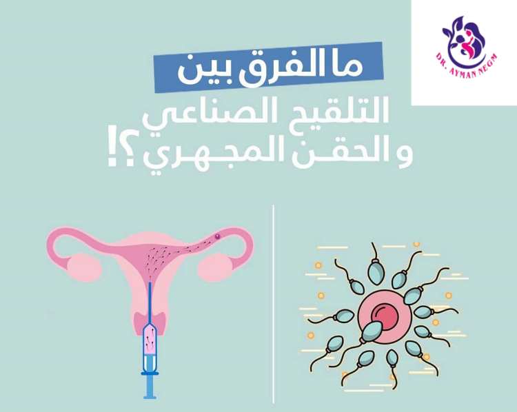 الفرق بين التلقيح الصناعي والحقن المجهري