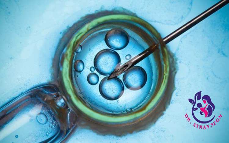 سعر عملية التلقيح الصناعي في مصر