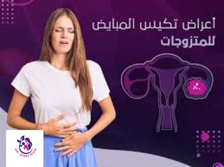 اعراض تكيس المبايض للمتزوجة 