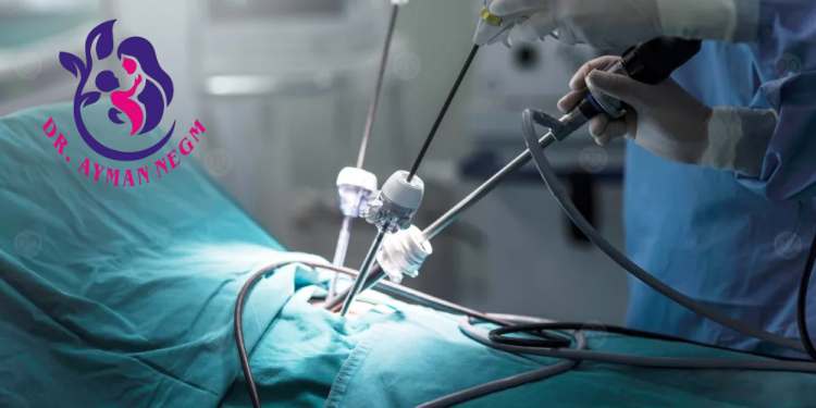 ما هي نسبة الحمل بعد عملية دوالي الخصية بالمنظار؟