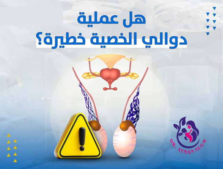 هل دوالي الخصية خطيرة؟