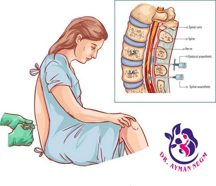 اضرار الولاده بدون الم
