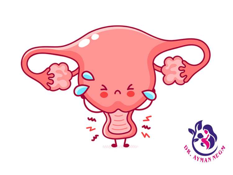 عملية ربط المبايض فيديو