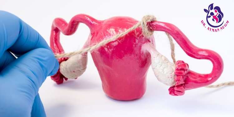 هل يمكن الحمل بعد عملية ربط قناة فالوب