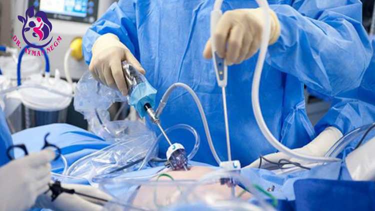 استئصال الرحم بالمنظار