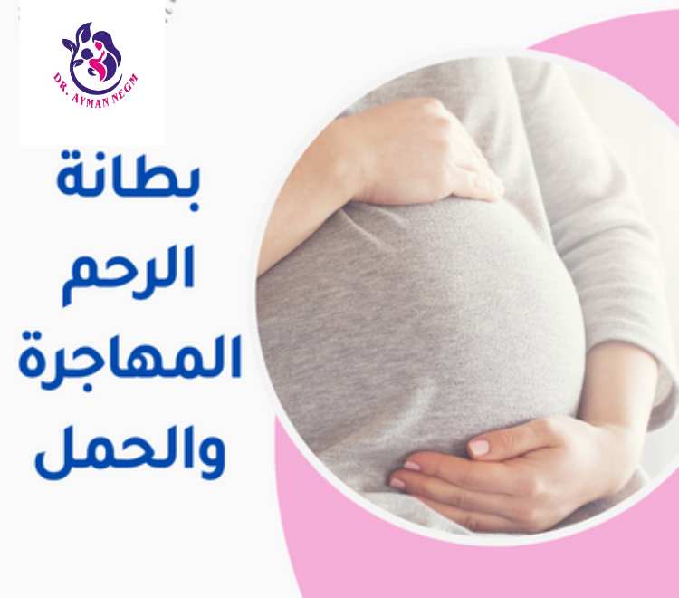 الحمل بعد عملية بطانة الرحم المهاجرة 