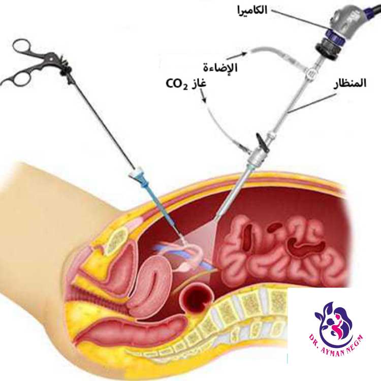 تكلفة عملية تنظيف الرحم في مصر