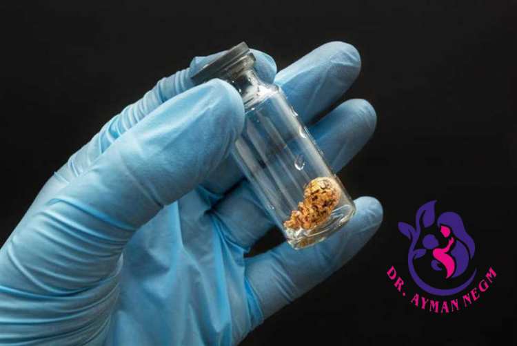 اضرار تجميد البويضات