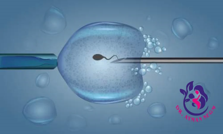 عروض الحقن المجهري: ما الذي تتضمنه؟