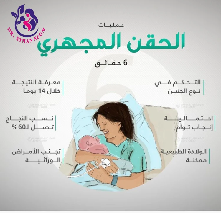 ما هو الحقن المجهري؟